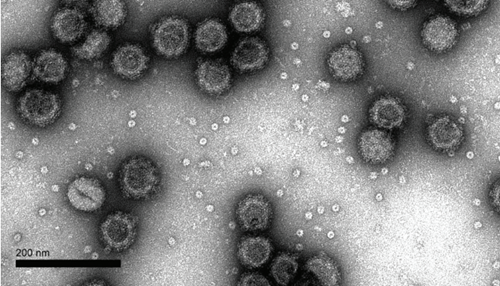 TEM Image of Dengue-2 VLPs